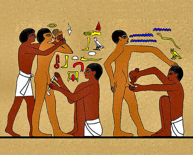 EgyptianCircumcision.jpg