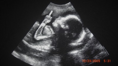 funny baby ultrasound picturesphoto