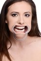 Cheek Retractor Dental Mouth Gag  AD836