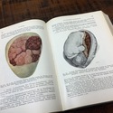 1935 German Medical Book Obstetrics Textbook by St