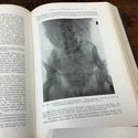 1935 German Medical Book Obstetrics Textbook by St